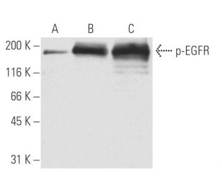 p-EGFR Antibody (9H2) - Western Blotting - Image 62887