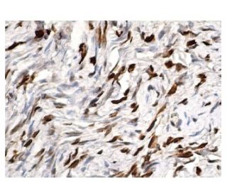 p-Elk-1 Antibody (B-4) - Immunohistochemistry - Image 156584 