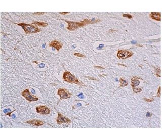 p-ERK 1/2 Antibody (pT202/pY204.22A) - Immunohistochemistry - Image 347978