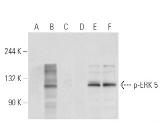 p-ERK 5 Antibody (1.T218/Y220) - Western Blotting - Image 93565