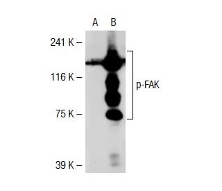 p-FAK Antibody (2D11) - Western Blotting - Image 38523 