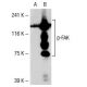 p-FAK Antibody (2D11) - Western Blotting - Image 38523 