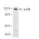 p-FAK Antibody (2D11) - Western Blotting - Image 62523