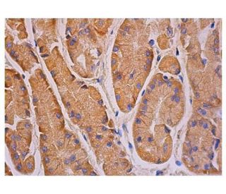 p-FAK Antibody (A-12) - Immunohistochemistry - Image 348943 