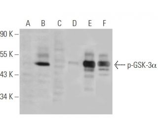 p-GSK-3&alpha; Antibody (9B8) - Western Blotting - Image 68145 