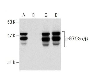 p-GSK3 alpha/beta Antibody (6D3) - Western Blotting - Image 138422 
