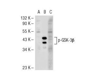 p-GSK3 beta Antibody (2D3) - Western Blotting - Image 55350 