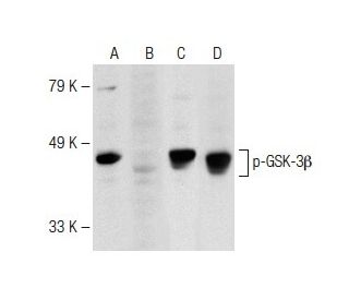 p-GSK3 beta Antibody (F-2) - Western Blotting - Image 148686 