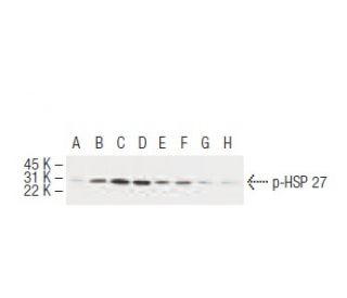 p-HSP 27 Antibody (5B9) - Western Blotting - Image 62926 