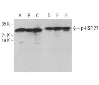 p-HSP 27 Antibody (B-3) - Western Blotting - Image 377112 