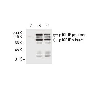p-IGF-1 Receptor/IGF1R Antibody (2B9) - Western Blotting - Image 62927