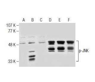p-JNK Antibody (14.Thr 183/Tyr 185) - Western Blotting - Image 164490 