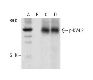 p-KV4.2 Antibody (C-6) - Western Blotting - Image 304565