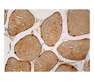 p-LKB1 Antibody (C-1) - Immunohistochemistry - Image 161045 