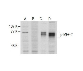 p-MEF-2 Antibody (B-11) - Western Blotting - Image 281413
