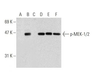 p-MEK-1/2 Antibody (7E10) - Western Blotting - Image 136017 