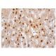 p-Met Antibody (F-5) - Immunohistochemistry - Image 349120 