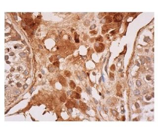 p-mTOR Antibody (296.Ser 2481) - Immunohistochemistry - Image 352293 