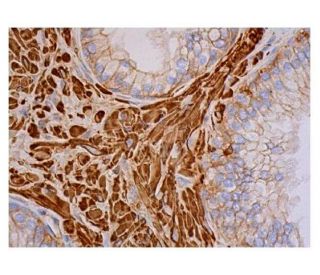 p-mTOR Antibody (Ser 2481 55.42) - Immunohistochemistry - Image 352289 