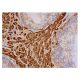p-mTOR Antibody (Ser 2481 55.42) - Immunohistochemistry - Image 352289 