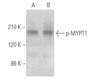 p-MYPT1 Antibody (F-11) - Western Blotting - Image 354080 