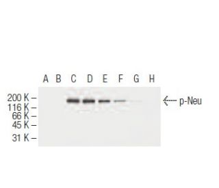 p-ErbB2/HER2 Antibody (19G5) - Western Blotting - Image 62945