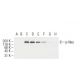p-ErbB2/HER2 Antibody (19G5) - Western Blotting - Image 62945