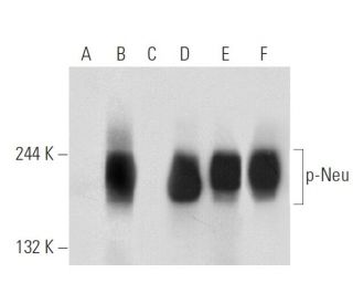 p-ErbB2/HER2 Antibody (6G7) - Western Blotting - Image 99688 