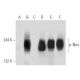 p-ErbB2/HER2 Antibody (6G7) - Western Blotting - Image 99688 
