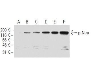 p-ErbB2/HER2 Antibody (9E10) - Western Blotting - Image 62935