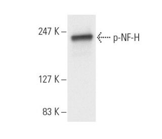 p-NF-H Antibody (RNF404) - Western Blotting - Image 9585 