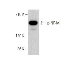 p-NF-M Antibody (RNF403) - Western Blotting - Image 376973 