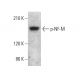 p-NF-M Antibody (RNF406) - Western Blotting - Image 376978 