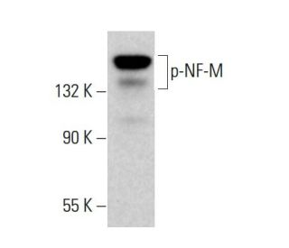 p-NF-M Antibody (RNF406) - Western Blotting - Image 381789 