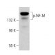 p-NF-M Antibody (RNF406) - Western Blotting - Image 381789 