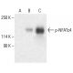 p-NFATc4 Antibody (80.S168/170) - Western Blotting - Image 401945 