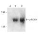 p-NFATc4 Antibody (80.S168/170) - Western Blotting - Image 402302