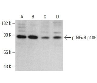 p-NF&kappa;B p105 Antibody (4.Ser 932) - Western Blotting - Image 377741 