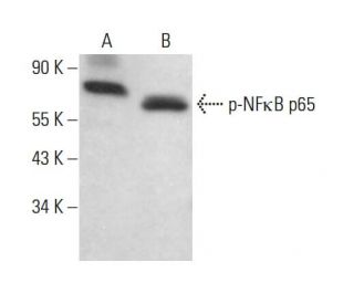 p-RELA/NF&kappa;B p65 Antibody (49.Ser 311) - Western Blotting - Image 380489 