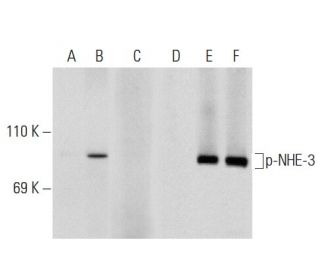 p-NHE-3 Antibody (10A8) - Western Blotting - Image 135376