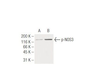 p-eNOS Antibody (15E2) - Western Blotting - Image 62936