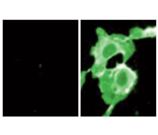 p-p120 Antibody (pY228.21A) - Immunofluorescence - Image 60528 
