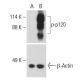 p-p120 Antibody (pY280.18) - Western Blotting - Image 399004