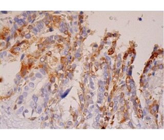 p-PAK4 Antibody (93.Ser 474) - Immunohistochemistry - Image 293300 