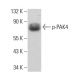 p-PAK4 Antibody (93.Ser 474) - Western Blotting - Image 380546