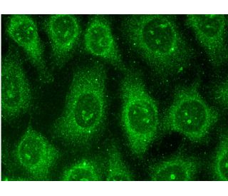 p-PDGF Receptor beta/PDGFRB Antibody (F-10) - Immunofluorescence - Image 145111 