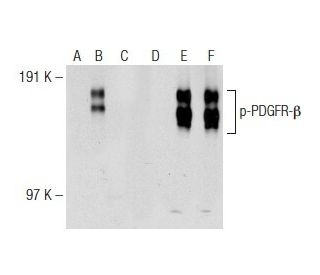 p-PDGF Receptor beta/PDGFRB Antibody (H-3) - Western Blotting - Image 141670 