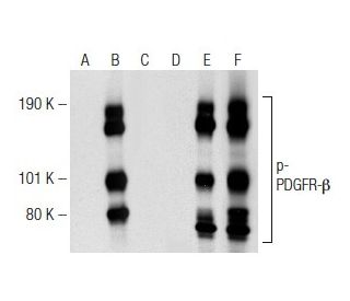 p-PDGF Receptor beta/PDGFRB Antibody (H-8) - Western Blotting - Image 148883 