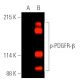 p-PDGF Receptor beta/PDGFRB Antibody (H-8) - Western Blotting - Image 391026