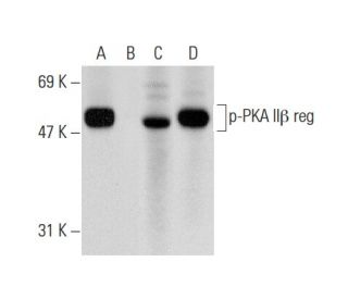 p-PKA II&beta; reg Antibody (pS114.20A) - Western Blotting - Image 135421 
